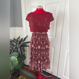 Tracy Reese Lace Dress NWOT